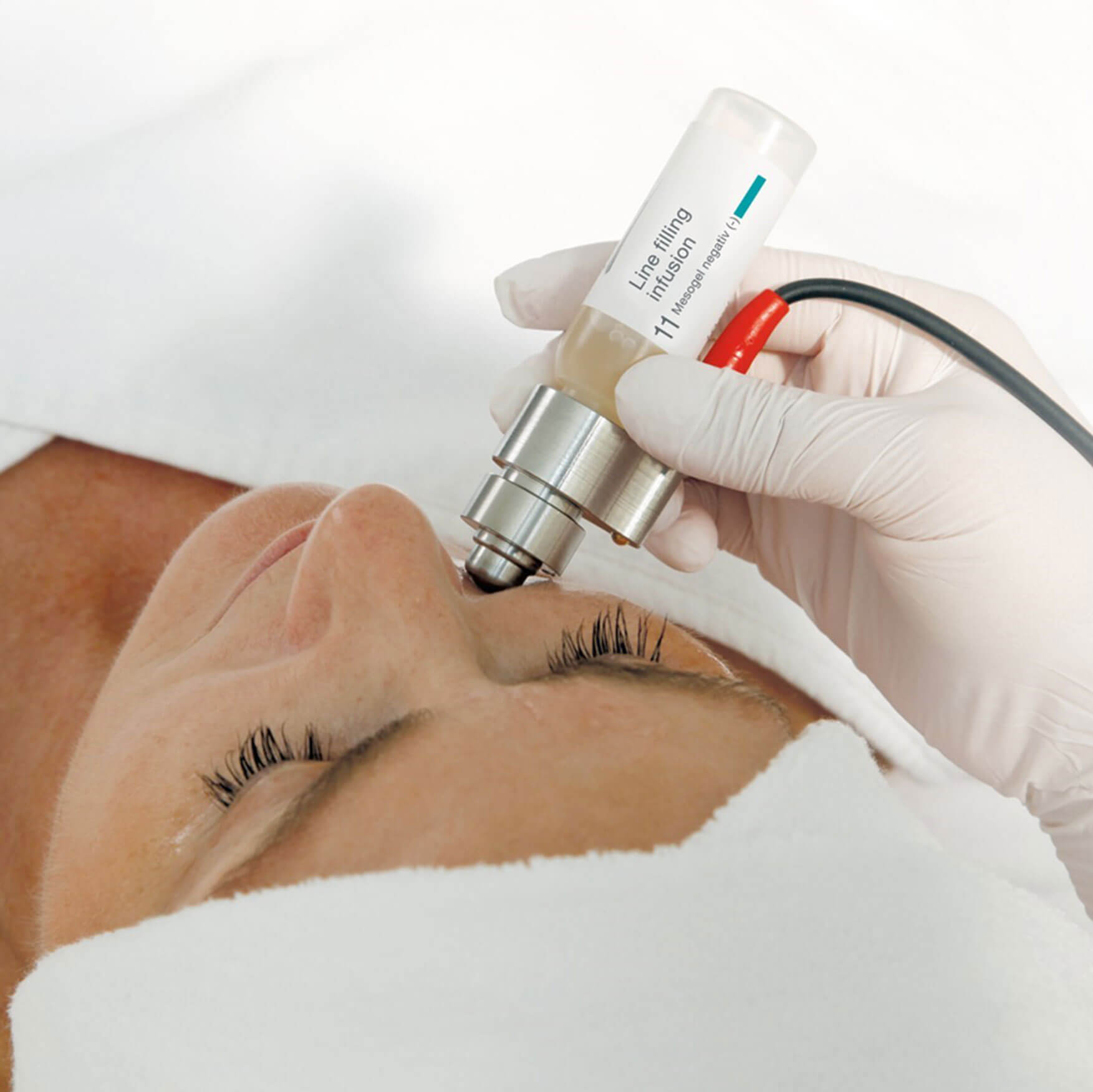 Intra Skin Behandlung - Computergestuerter Stromimplus