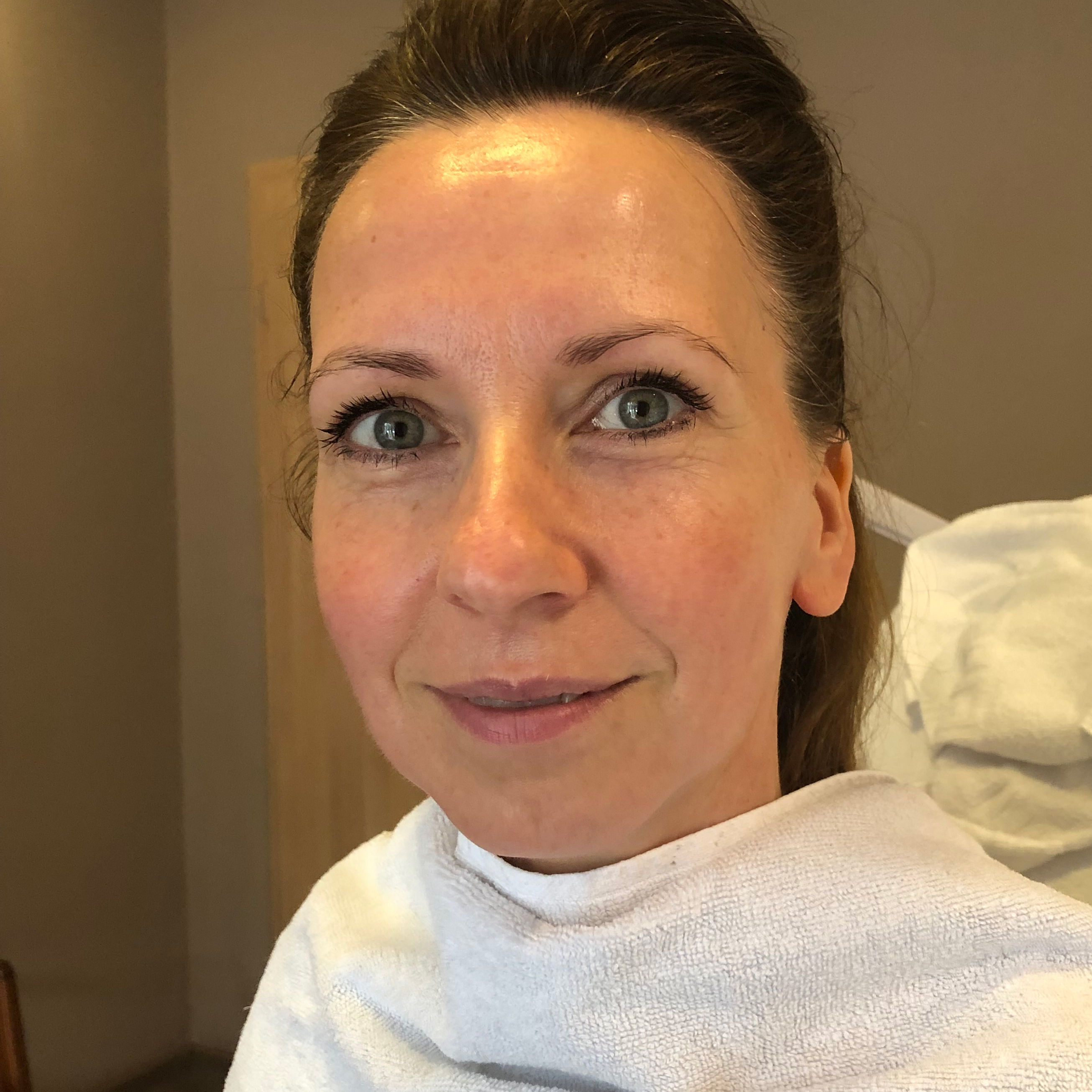 Person mit glänzender und erfrischter Haut nach Behandlung