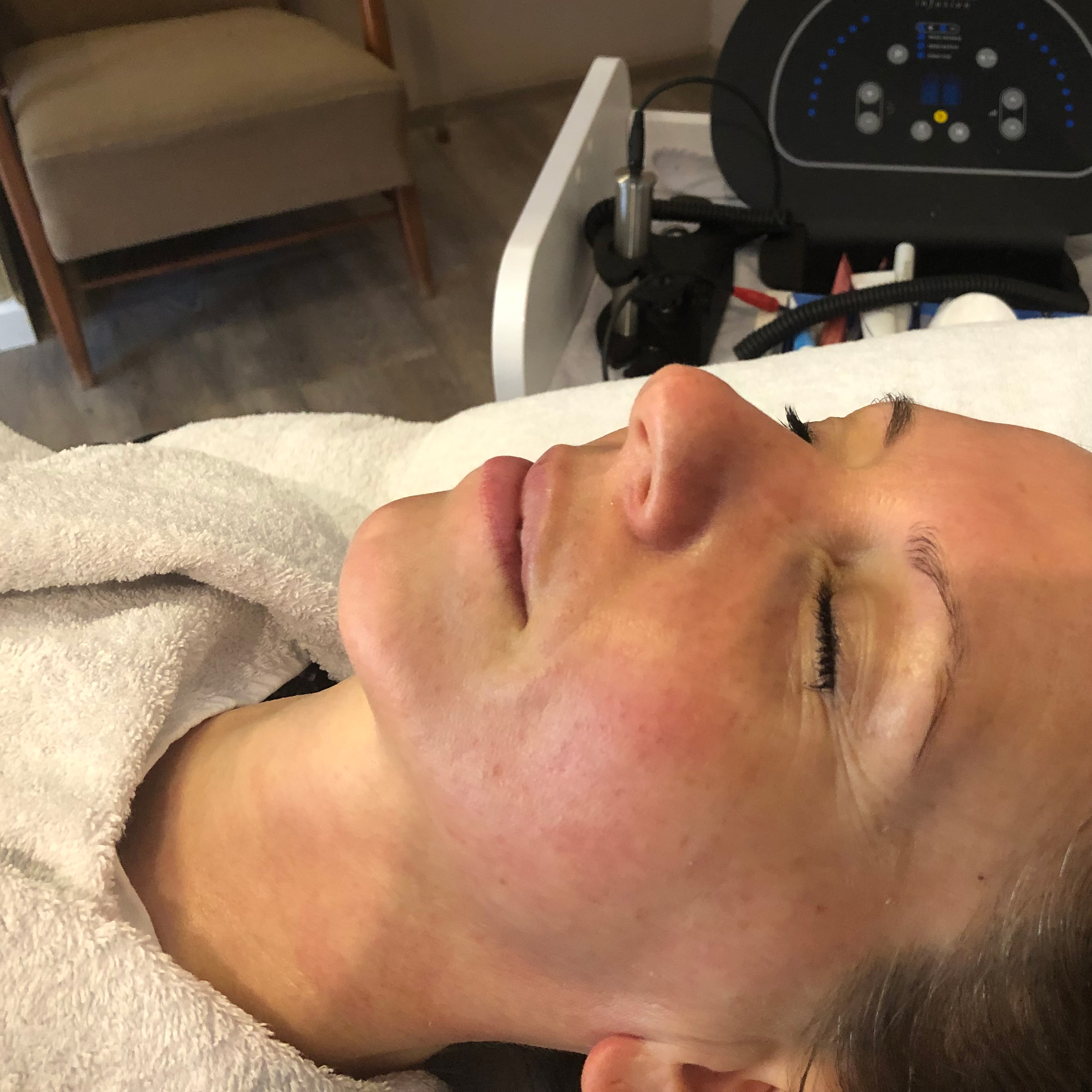 Person mit geröteter Gesichtshaut liegt entspannt bei einer kosmetischen Behandlung.